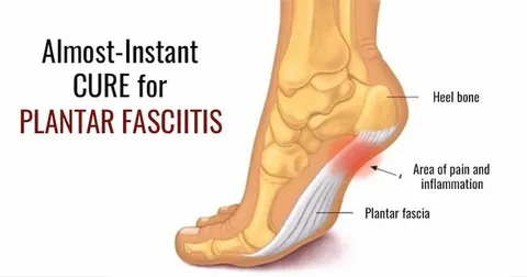 Structural Asymmetry Findings Often Identified by a Plantar Fasciitis Specialist